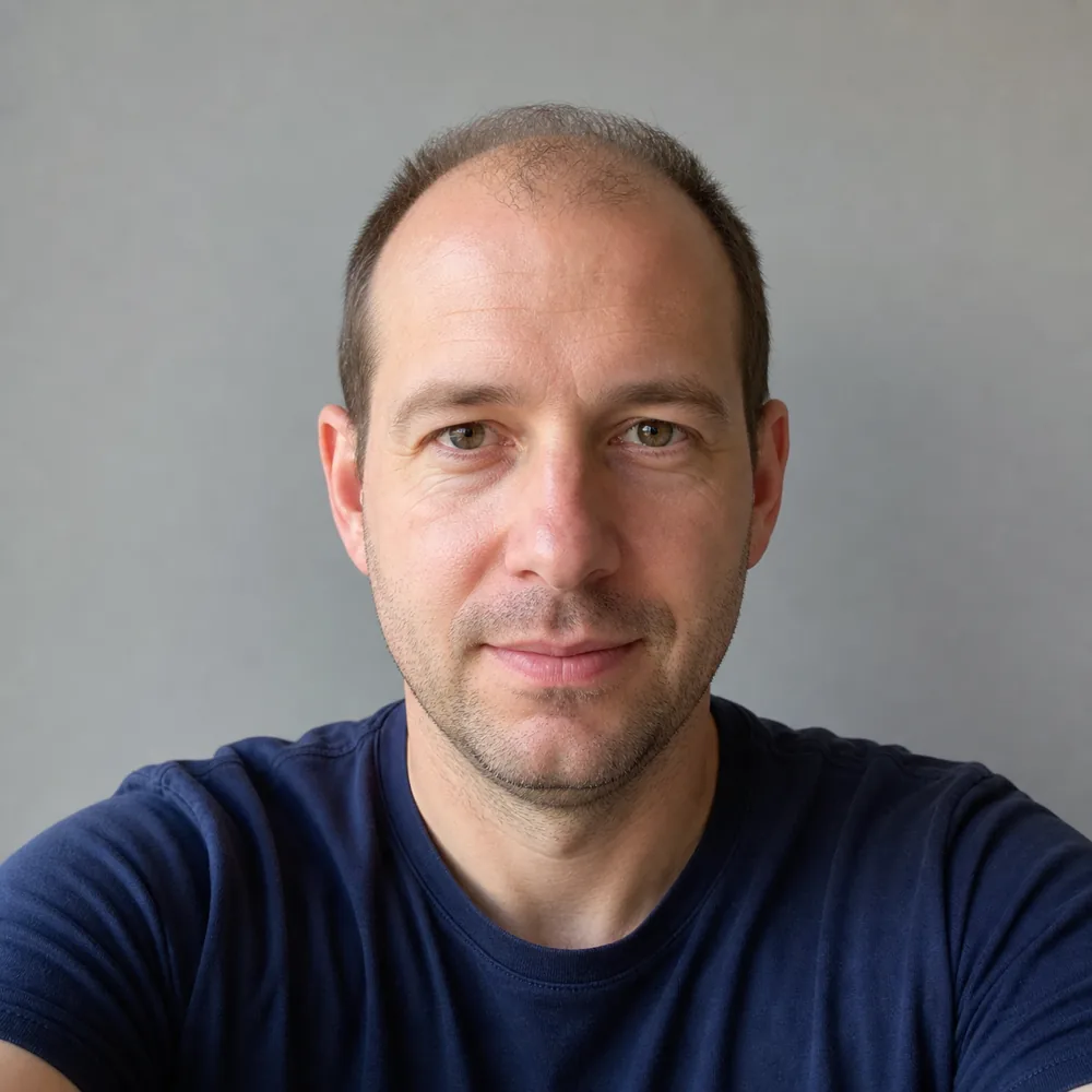 Theo before, with a receding hairline and thinning hair on top