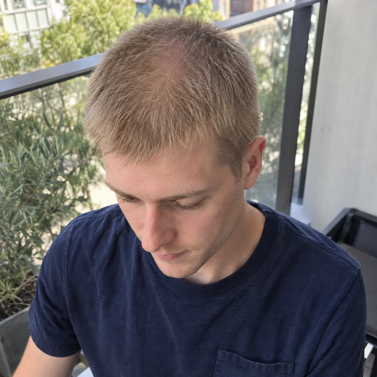 Man with fine light blonde hair cut with an 8 guard, scalp showing through on top, looking down on a sunny balcony